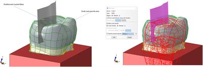 Effects on different full-coverage designs and materials of crack propagation in first mandibular molar: an extended finite element method study